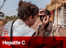 Hepatite C