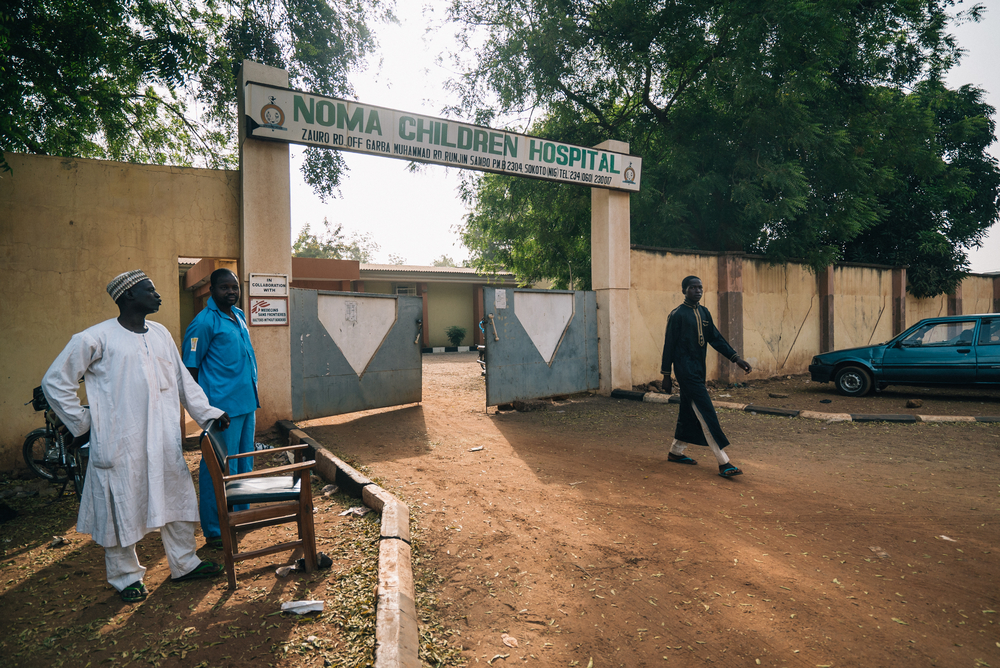 Conheça a história de Mulikat, uma sobrevivente do noma na Nigéria Conheça a história de Mulikat, uma sobrevivente do noma na Nigéria