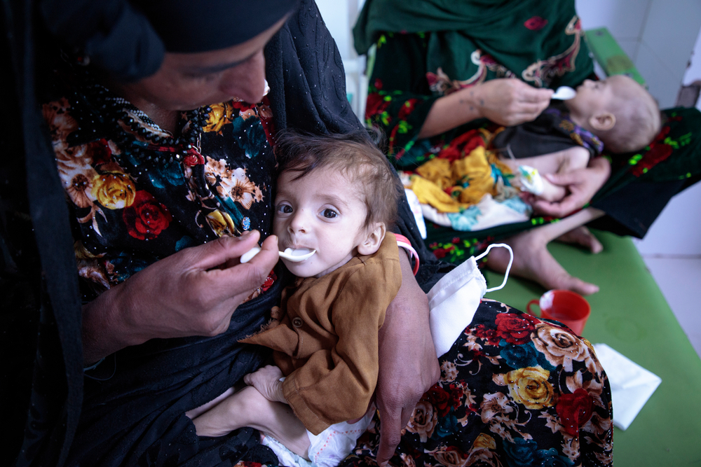 Desnutrição aumenta em Herat enquanto cuidados de saúde estão à beira do colapso no Afeganistão Desnutrição aumenta em Herat enquanto cuidados de saúde estão à beira do colapso no Afeganistão