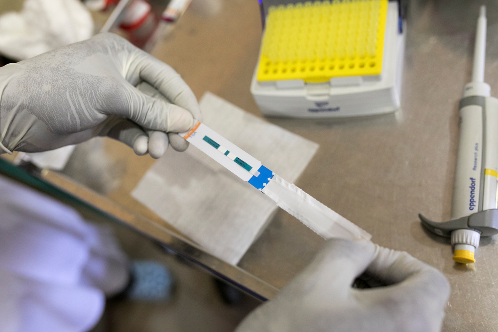 Tuberculose: novos testes e medicamentos seguem fora do alcance de muitos pacientes Tuberculose: novos testes e medicamentos seguem fora do alcance de muitos pacientes