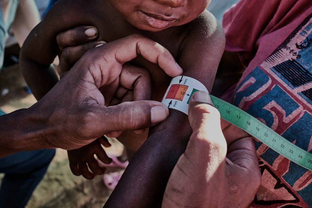 A desnutrição ameaça a população de algumas regiões de Madagascar A desnutrição ameaça a população de algumas regiões de Madagascar