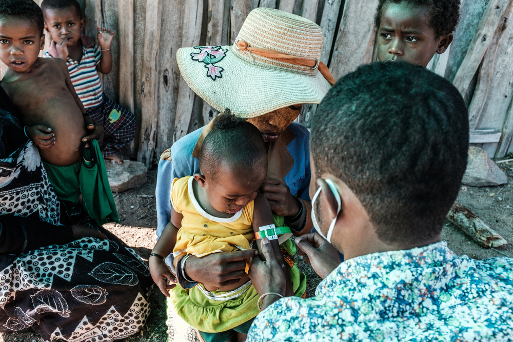 Foto: Erwan Rogard/MSF Madagascar: MSF intensifica resposta à crise nutricional na região Sul