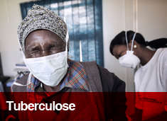 Tuberculose Tuberculose