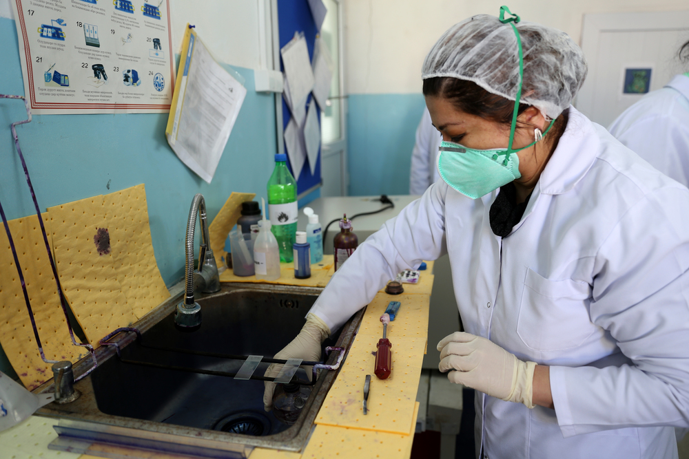 Técnico de laboratório de MSF analisa amostra de escarro no hospital nacional pediátrico de tuberculose em Dushanbe, no Tadjiquistão. (Foto: Joosarang Lee/MSF) Técnico de laboratório de MSF analisa amostra de escarro no hospital nacional pediátrico de tuberculose em Dushanbe, no Tadjiquistão. (Foto: Joosarang Lee/MSF)