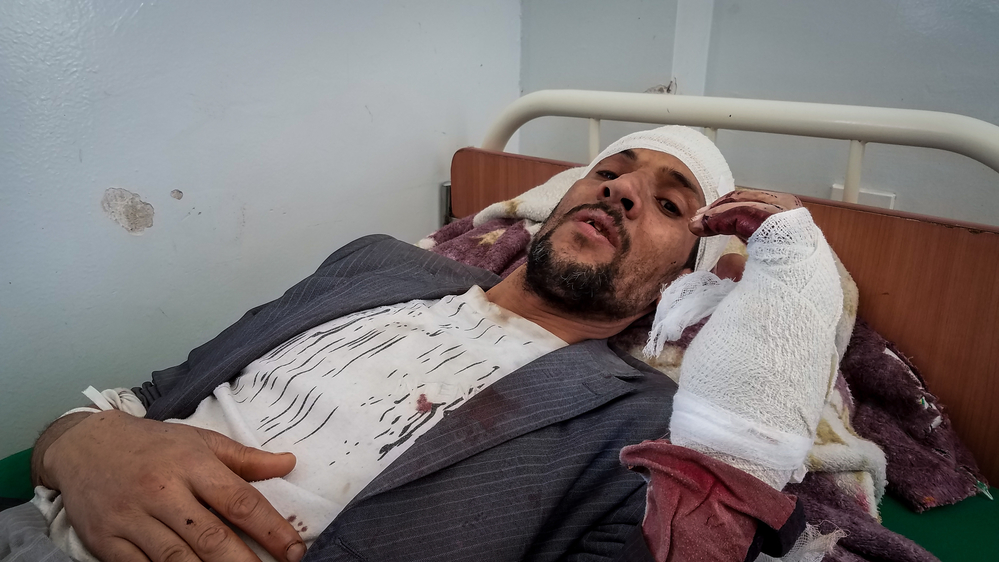Iêmen: hospitais apoiados por MSF tratam vítimas de ataques aéreos em Sanaa Iêmen: hospitais apoiados por MSF tratam vítimas de ataques aéreos em Sanaa