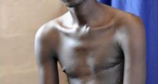 Restaurando o corpo e a mente: fisioterapia no hospital SICA, na República Centro-Africana Restaurando o corpo e a mente: fisioterapia no hospital SICA, na República Centro-Africana