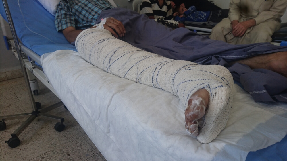 Hospital em Hassakeh recebe mais vítimas de ataques aéreos no norte da Síria Hospital em Hassakeh recebe mais vítimas de ataques aéreos no norte da Síria